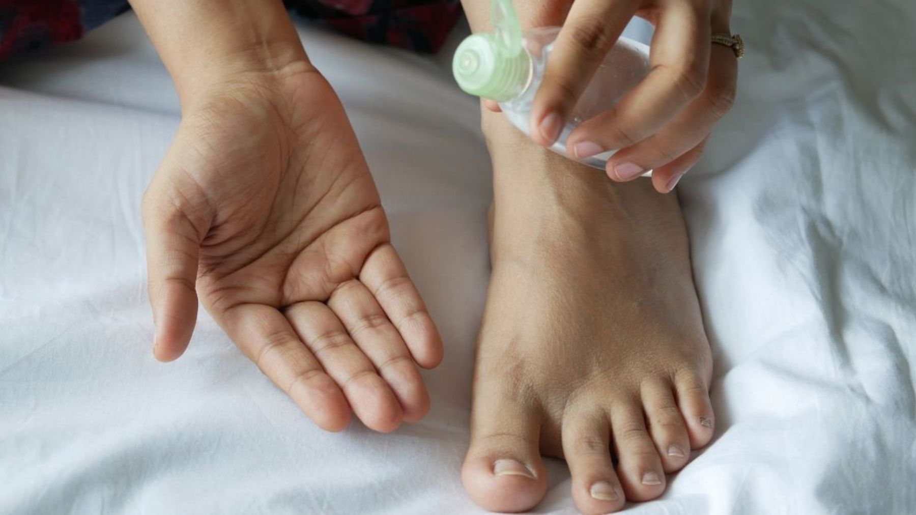 Cracked heels: 10 natural remedies to solve the problem